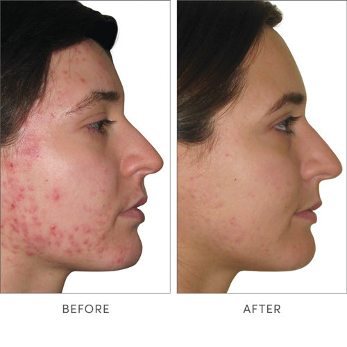 Jane Iredale Skin Accumax